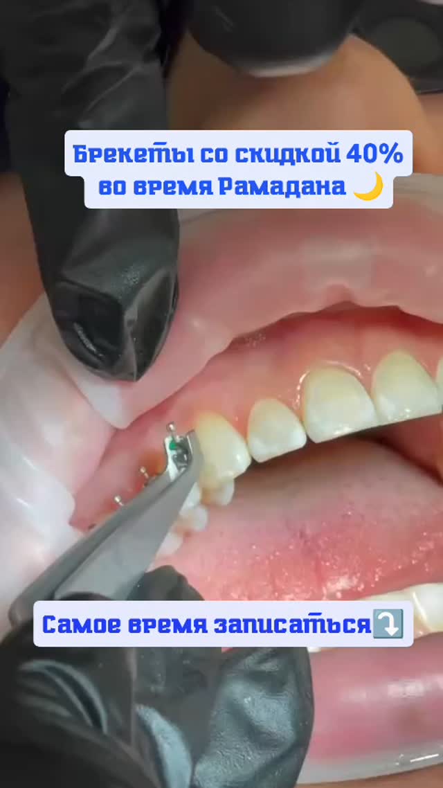 Консультация и диагностика
